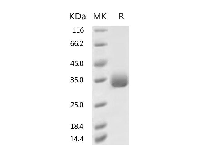 HKU1-CoV S1 Protein - Recombinant 2019-nCoV Spike Protein (RBD, His Tag)(F342L)-Elabscience