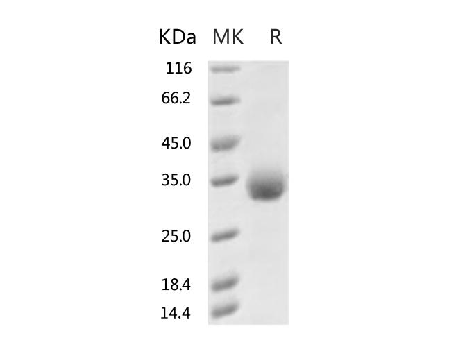 HKU1-CoV S1 Protein - Recombinant 2019-nCoV Spike Protein (RBD, His Tag)(N354D)-Elabscience