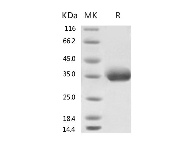 HKU1-CoV S1 Protein - Recombinant 2019-nCoV Spike Protein, Biotinylated (RBD, His Tag)-Elabscience