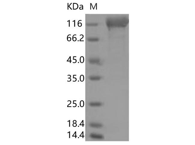 HKU1-CoV S1 Protein - Recombinant 2019-nCoV S1 Protein, Biotinylated (Avi-His Tag)(Active)