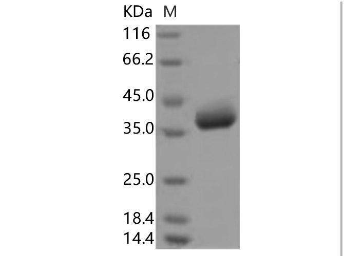 HKU1-CoV S1 Protein - Recombinant 2019-nCoV Spike Protein, Biotinylated (RBD, Avi-His Tag)(Active)