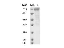 HKU1-CoV S1 Protein - Recombinant 2019-nCoV S2 Protein (ECD, Fc Tag)-Elabscience