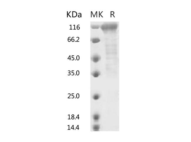 HKU1-CoV S1 Protein - Recombinant 2019-nCoV S2 Protein (ECD, Fc Tag)-Elabscience