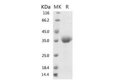 HKU1-CoV S1 Protein - Recombinant 2019-nCoV Spike Protein (RBD)-Elabscience