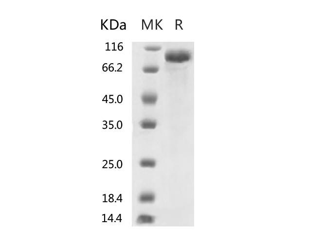 HKU1-CoV S1 Protein - Recombinant 2019-nCoV S2 Protein (mFc Tag)-Elabscience