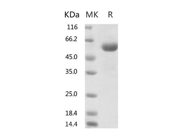 HKU1-CoV S1 Protein - Recombinant 2019-nCoV Spike Protein (RBD, mFc Tag)(V367F)-Elabscience