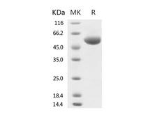 HKU1-CoV S1 Protein - Recombinant 2019-nCoV Spike Protein (RBD, rFc Tag)-Elabscience