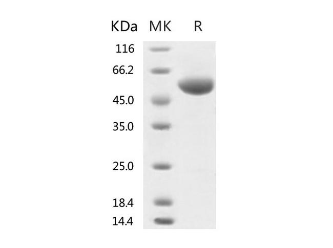 HKU1-CoV S1 Protein - Recombinant 2019-nCoV Spike Protein (RBD, rFc Tag)-Elabscience
