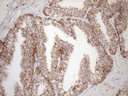 VISA / MAVS Antibody - Immunohistochemical staining of paraffin-embedded Human prostate tissue within the normal limits using anti-MAVS mouse monoclonal antibody. (Heat-induced epitope retrieval by 1mM EDTA in 10mM Tris buffer. (pH8.5) at 120 oC for 3 min. (1:150)