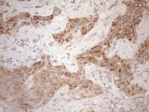 VISA / MAVS Antibody - Immunohistochemical staining of paraffin-embedded Human liver tissue within the normal limits using anti-MAVS mouse monoclonal antibody. (Heat-induced epitope retrieval by 1mM EDTA in 10mM Tris buffer. (pH8.5) at 120 oC for 3 min. (1:150)