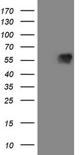 VISA / MAVS Antibody - HEK293T cells were transfected with the pCMV6-ENTRY control. (Left lane) or pCMV6-ENTRY MAVS. (Right lane) cDNA for 48 hrs and lysed. Equivalent amounts of cell lysates. (5 ug per lane) were separated by SDS-PAGE and immunoblotted with anti-MAVS. (1:2000)