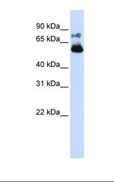 VISA / MAVS Antibody - Transfected 293T cell lysate. Antibody concentration: 1.0 ug/ml. Gel concentration: 12%.  This image was taken for the unconjugated form of this product. Other forms have not been tested.