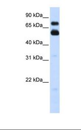 VISA / MAVS Antibody - Transfected 293T cell lysate. Antibody concentration: 1.0 ug/ml. Gel concentration: 12%.  This image was taken for the unconjugated form of this product. Other forms have not been tested.