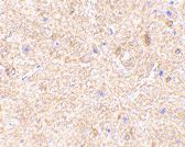 VISA / MAVS Antibody - Immunohistochemistry of mouse brain with Rabbit anti-Human VISA