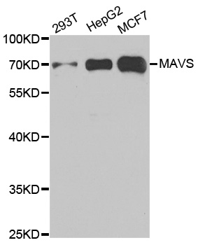 VISA / MAVS Antibody - Western blot analysis of extracts of various cell lines.