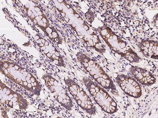 VISA / MAVS Antibody - Immunochemical staining of human MAVS in human rectum with rabbit polyclonal antibody at 1:100 dilution, formalin-fixed paraffin embedded sections.