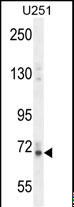 VIT Antibody - VITRN Antibody western blot of U251 cell line lysates (35 ug/lane). The VITRN antibody detected the VITRN protein (arrow).