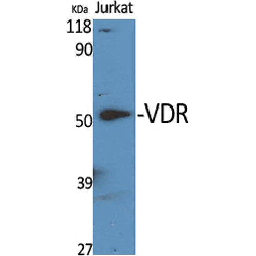 Vitamin D Receptor / VDR Antibody - Western blot of VDR antibody