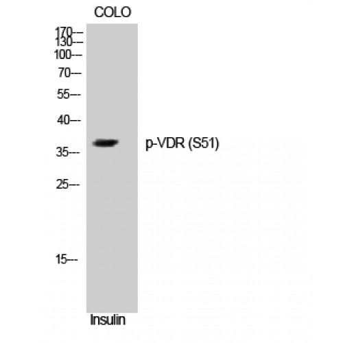 Vitamin D Receptor / VDR Antibody - Western blot of Phospho-VDR (S51) antibody