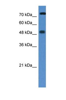 Vitamin D Receptor / VDR Antibody - VDR antibody Western blot of Jurkat Cell lysate. Antibody concentration 1 ug/ml. This image was taken for the unconjugated form of this product. Other forms have not been tested.