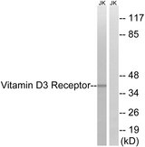 Vitamin D Receptor / VDR Antibody - Western blot analysis of lysates from Jurkat cells, using Vitamin D3 Receptor Antibody. The lane on the right is blocked with the synthesized peptide.