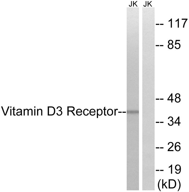 Vitamin D Receptor / VDR Antibody - Western blot analysis of lysates from Jurkat cells, using Vitamin D3 Receptor Antibody. The lane on the right is blocked with the synthesized peptide.