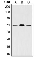 Vitamin D Receptor / VDR Antibody - Western blot analysis of VDR expression in HeLa (A); T47D (B); MCF7 (C) whole cell lysates.