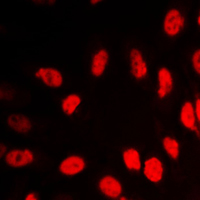 Vitamin D Receptor / VDR Antibody - Immunofluorescent analysis of VDR staining in HeLa cells. Formalin-fixed cells were permeabilized with 0.1% Triton X-100 in TBS for 5-10 minutes and blocked with 3% BSA-PBS for 30 minutes at room temperature. Cells were probed with the primary antibody in 3% BSA-PBS and incubated overnight at 4 C in a humidified chamber. Cells were washed with PBST and incubated with a DyLight 594-conjugated secondary antibody (red) in PBS at room temperature in the dark. DAPI was used to stain the cell nuclei (blue).