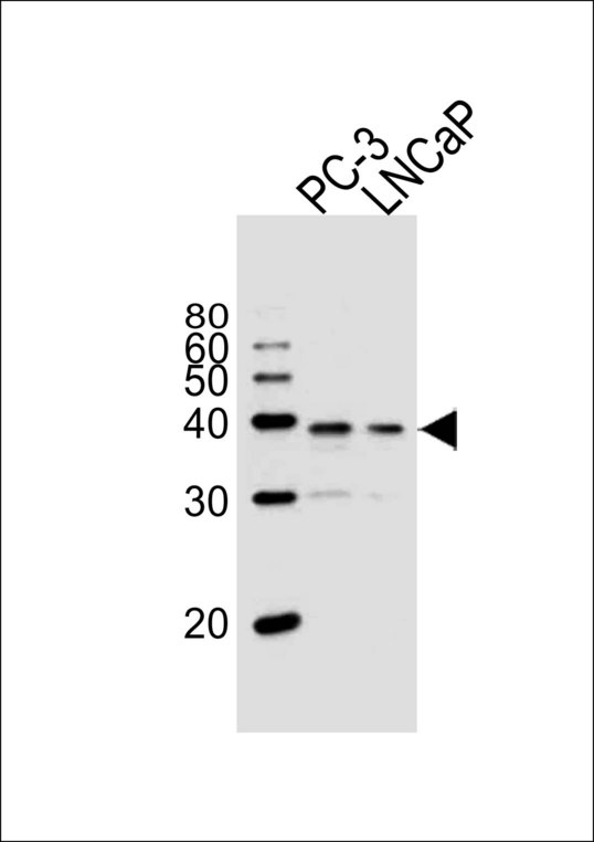 Vitamin D Receptor / VDR Antibody - Western blot of lysates from PC-3, LNCaP cell line (from left to right), using VDR Antibody. Antibody was diluted at 1:1000 at each lane. A goat anti-rabbit IgG H&L (HRP) at 1:10000 dilution was used as the secondary antibody.