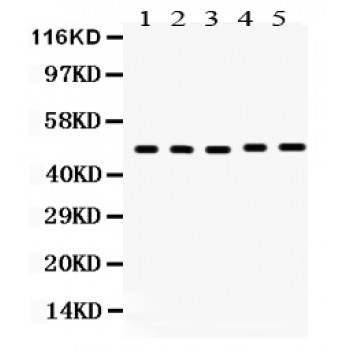 Vitamin D Receptor / VDR Antibody - VDR antibody Western blot. All lanes: Anti VDR at 0.5 ug/ml. Lane 1: Human Placenta Tissue Lysate at 50 ug. Lane 2: Rat Kidney Tissue Lysate at 50 ug. Lane 3: Rat Liver Tissue Lysate at 50 ug. Lane 4: Rat Pancreas Tissue Lysate at 50 ug. Lane 5: HELA Whole Cell Lysate at 40 ug. Predicted band size: 48 kD. Observed band size: 48 kD.