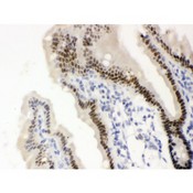 Vitamin D Receptor / VDR Antibody - VDR antibody IHC-paraffin. IHC(P): Mouse Intestine Tissue.