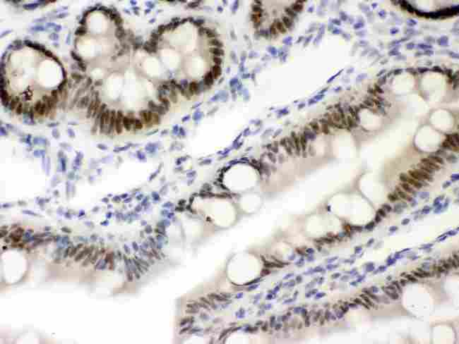 Vitamin D Receptor / VDR Antibody - Anti-VDR Picoband antibody IHC(P): Rat Intestine Tissue