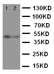 Vitamin D Receptor / VDR Antibody - WB of Vitamin D Receptor / VDR antibody. Lane 1: MCF-7 Cell Lysate. Lane 2: HELA Cell Lysate.