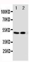 Vitamin D Receptor / VDR Antibody - Anti-VDR antibody, Western blotting Lane 1: MCF-7 Cell LysateLane 2: HELA Cell Lysate