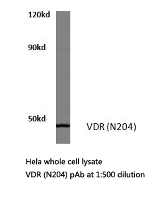 Vitamin D Receptor / VDR Antibody - Western blot of VDR (N204) pAb in extracts from HeLa cells.