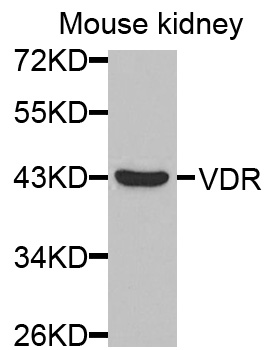 Vitamin D Receptor / VDR Antibody - Western blot analysis of extracts of mouse kidney cells.
