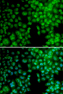 Vitamin D Receptor / VDR Antibody - Immunofluorescence analysis of A549 cells.