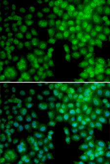 Vitamin D Receptor / VDR Antibody - Immunofluorescence analysis of A549 cells.