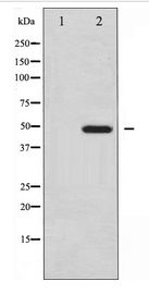 Vitamin D Receptor / VDR Antibody - Western blot of Vitamin D Receptor expression in Jurkat whole cell lysates,The lane on the left is treated with the antigen-specific peptide.