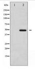 Vitamin D Receptor / VDR Antibody - Western blot of Vitamin D Receptor expression in Jurkat whole cell lysates,The lane on the left is treated with the antigen-specific peptide.