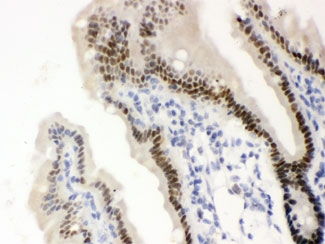 Vitamin D Receptor / VDR Antibody - IHC testing of FFPE mouse intestine with SLC22A2 antibody. HIER: Boil the paraffin sections in pH 6, 10mM citrate buffer for 20 minutes and allow to cool prior to staining.