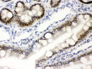 Vitamin D Receptor / VDR Antibody - IHC testing of FFPE rat intestine with SLC22A2 antibody. HIER: Boil the paraffin sections in pH 6, 10mM citrate buffer for 20 minutes and allow to cool prior to staining.