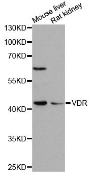 Vitamin D Receptor / VDR Antibody - Western blot analysis of extracts of various cell lines, using VDR antibody at 1:3000 dilution. The secondary antibody used was an HRP Goat Anti-Rabbit IgG (H+L) at 1:10000 dilution. Lysates were loaded 25ug per lane and 3% nonfat dry milk in TBST was used for blocking. An ECL Kit was used for detection and the exposure time was 90s.