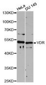 Vitamin D Receptor / VDR Antibody - Western blot analysis of extracts of various cell lines, using VDR antibody at 1:3000 dilution. The secondary antibody used was an HRP Goat Anti-Rabbit IgG (H+L) at 1:10000 dilution. Lysates were loaded 25ug per lane and 3% nonfat dry milk in TBST was used for blocking. An ECL Kit was used for detection and the exposure time was 90s.