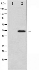 Vitamin D Receptor / VDR Antibody - Western blot analysis of Vitamin D Receptor expression in Jurkat whole cells lysates. The lane on the left is treated with the antigen-specific peptide.