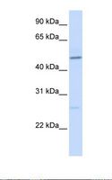 Vitamin D Receptor / VDR Antibody - Fetal brain lysate. Antibody concentration: 1.0 ug/ml. Gel concentration: 12%.  This image was taken for the unconjugated form of this product. Other forms have not been tested.