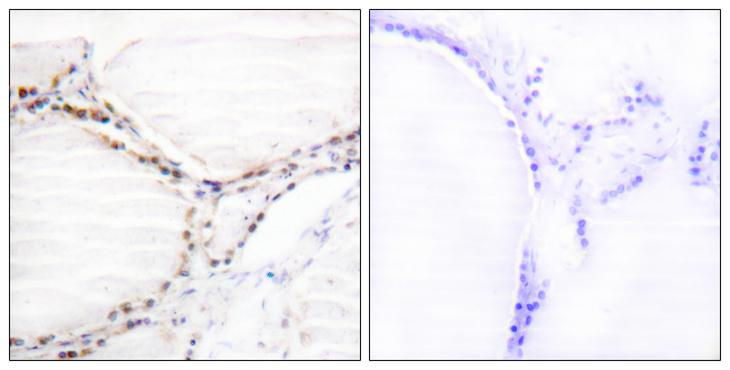 Vitamin D Receptor / VDR Antibody - Peptide - + Immunohistochemistry analysis of paraffin-embedded human thyroid gland tissue using Vitamin D Receptor (Ab-208) antibody.