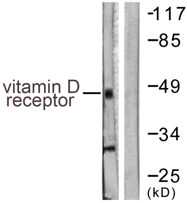 Vitamin D Receptor / VDR Antibody - Western blot analysis of extracts from Jurkat cells, using Vitamin D Receptor (Ab-208) antibody.