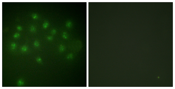 Vitamin D Receptor / VDR Antibody - Immunofluorescence analysis of A549 cells, using Vitamin D Receptor (Phospho-Ser208) Antibody. The picture on the right is blocked with the phospho peptide.