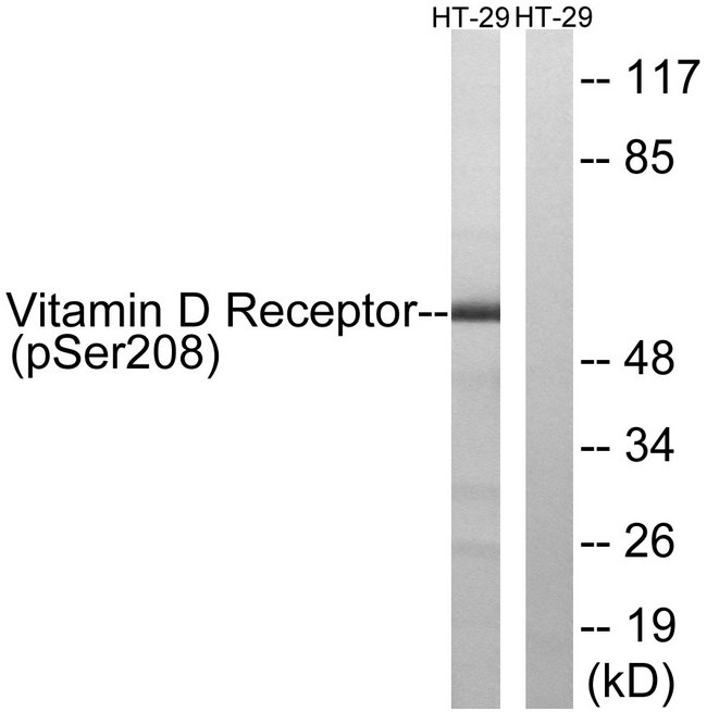 Vitamin D Receptor / VDR Antibody - Western blot analysis of lysates from HT29 cells treated with heat shock, using Vitamin D Receptor (Phospho-Ser208) Antibody. The lane on the right is blocked with the phospho peptide.